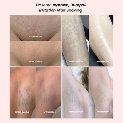 Glow Trim Duo Shaver™: Women's 2-in-1 Electric Wet/Dry Body & Intimate Hair Remover