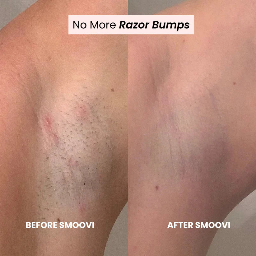 Glow Trim Duo Shaver™: Women's 2-in-1 Electric Wet/Dry Body & Intimate Hair Remover